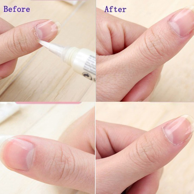 قلم زيت للبشرة المحيطة بالأظاف - مراجعة Cuticle Oil Pen وسعره
