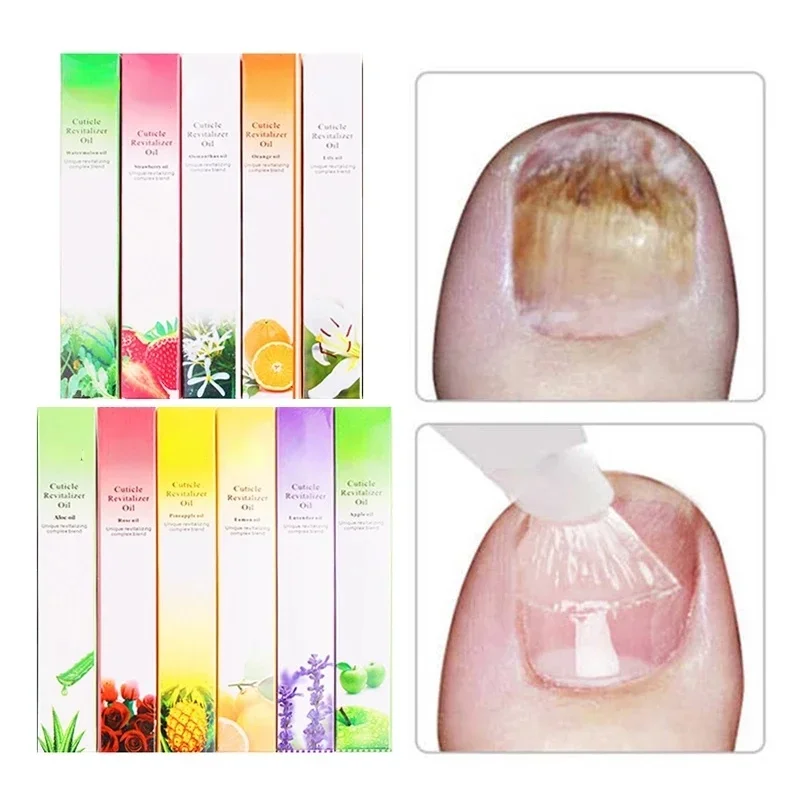 6 قطعة قلم زيت البشرة تغذية ال - مراجعة Cuticle Oil Pen وسعره