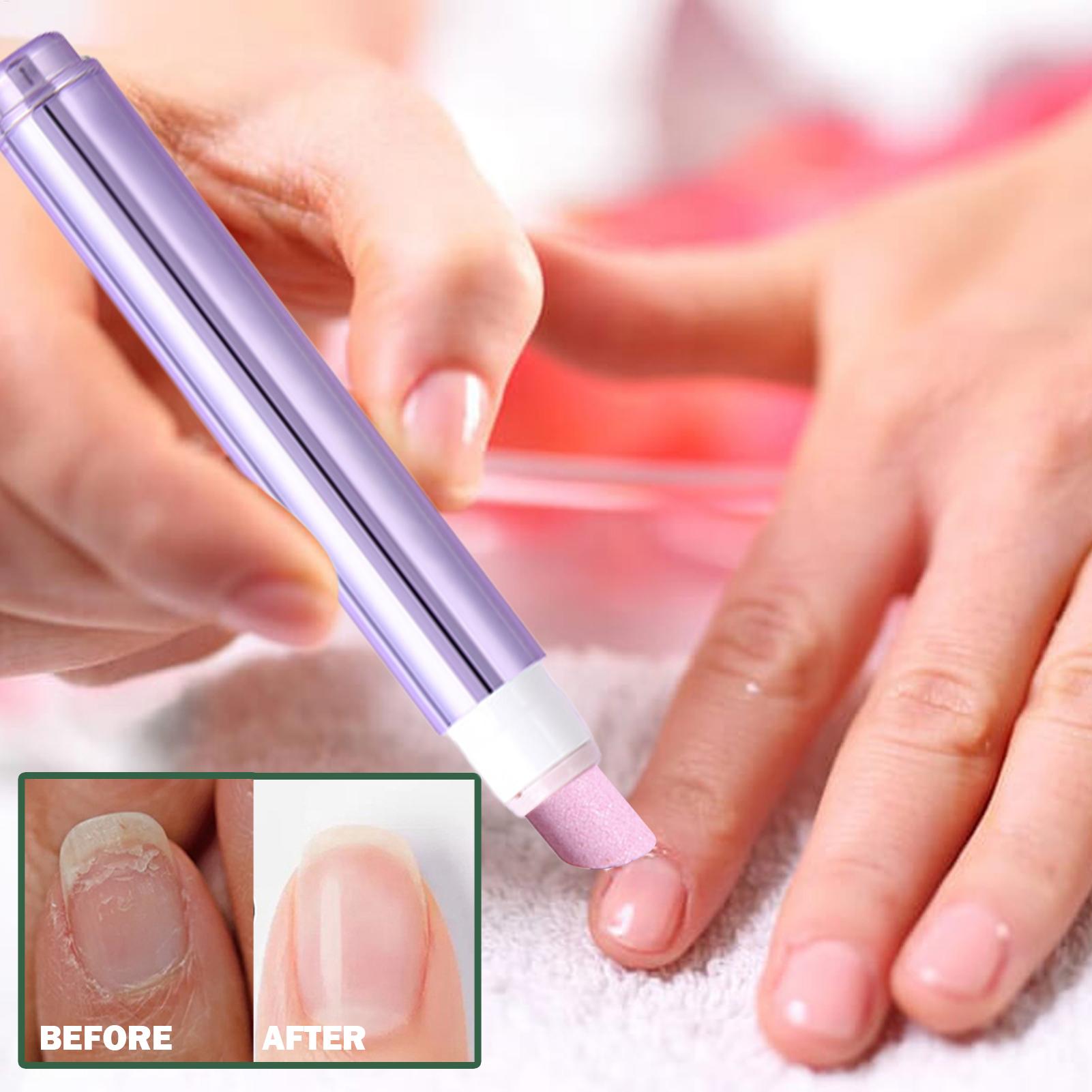 قلم العناية بالأظافر 2 في 1 مع - مراجعة Cuticle Oil Pen وسعره